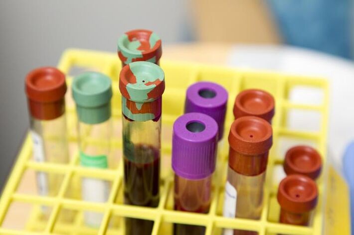 blood tests to determine the diagnosis of back pain